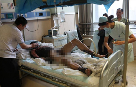 Một nạn nhân bị thương vì vụ nổ ở mỏ than Taozigou nằm trong bệnh viện.